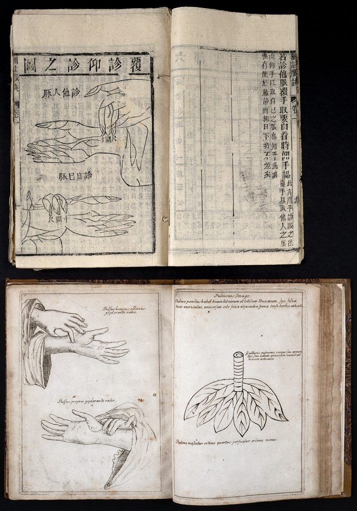 Historic illustration of pulse taking in Chinese medicine